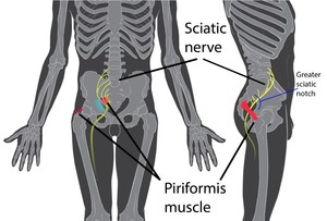 yoga-for-sciatica-relief-1-300x203 Understanding yoga for sciatica prevention