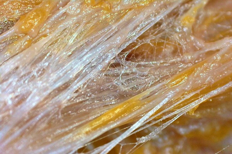 Fascia Structure Fascia Structure